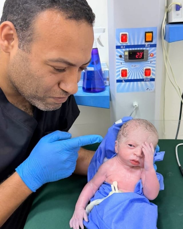 An image of a newborn baby with an unusual expression was captured next to the OB-GYN doctor who helped deliver it.